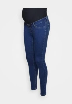 Jeans Skinny Fit - Blue -Anna Field 2548f84b1aea4b11b9ae9143ff073454